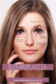 cirurgia nas palpebras blefaroplastia cirurgia plastica oftalmologista