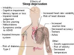 Sleep Deprivation Wikipedia