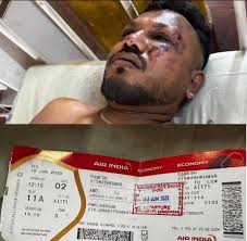 Los milagros existen! ÚNICO SOBREVIVIENTE 😳🙏🏼 del avión que se estrelló  en India, muriendo 242 personas a bordo.