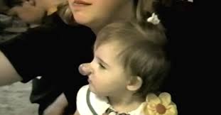 Real Life 'Pinocchio Girl' Has Nose That Is Constantly Growing