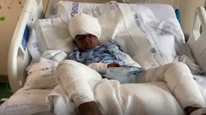 Gov't continues to support boy mauled by dogs in St Ann last year