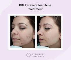 Synergy advanced medical aesthetics provides best spa services in solana beach, ca. Synergy Medical Aesthetics Home Facebook