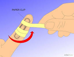 How To Treat Mallet Finger With A Splint Mallet Finger Splint Hand Therapy Finger Exercises