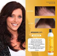 Biotin Shampoo Before And After Men Vitamins Hair Growth Shampoo 121 Regrowth And 47 Less Thinning With Dht Blockers And Biotin Hair Loss Shampoo Vitamins For Hair Growth Biotin Hair Growth