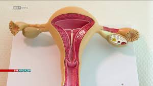 Nun hab ich seit 2 tagen bisschen ziehen in der muttermundgegend. Hormonspiralen Und Ihre Nebenwirkungen Youtube
