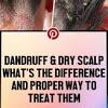 The main reason that scalp conditions like seborrheic dermatitis, seborrhea, dandruff (both mild and severe), scalp acne, folliculitis and just a plain itchy scalp cause hair thinning and ultimately loss is due to the disruption that occurs inside the hair follicle. 3