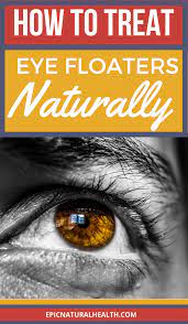 Eye Floaters Block Your Peripheral Vision They Look Like Unshapen Strands That But They Resemble Cloud Specs Eye Health Remedies Eye Floaters Cure Eye Health