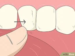 Sometimes this is not a good route to go though and you need to do a bit of an operation. 12 Ways To Pull A Loose Tooth At Home Wikihow