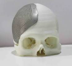 India's Incredible 3D achieves a milestone of 3000 Patient ...