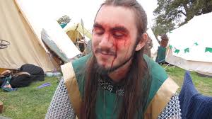 Missed connection: You were a navarri physick and saved my life towards the  end of the Sunday battle. I had taken an arrow to the back of my head and  needed attention,