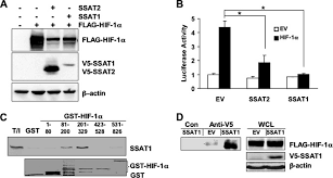 Hemmalaget siktar på att studsa tillbaka efter förlust. Spermidine Spermine N1 Acetyltransferase 1 Binds To Hypoxia Inducible Factor 1a Hif 1a And Rack1 And Promotes Ubiquitination And Degradation Of Hif 1a Journal Of Biological Chemistry