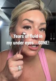 Nurse Jane Roller under Eyes