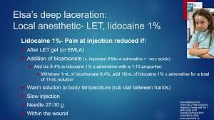 Image result for LET Anesthesia