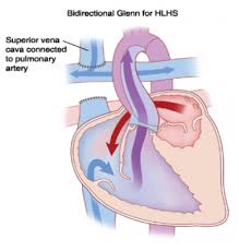 Pin On Cardiology Sonography