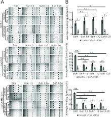 If you've undergone a lumpectomy, the cancer could recur in the remaining breast tissue. Migration Of Metastatic Breast Cancer Cells Was Promoted By Stiff Download Scientific Diagram