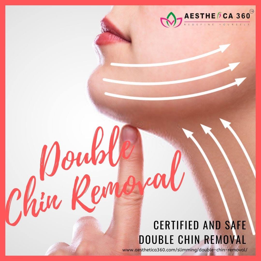 Double Chin Reduction product image