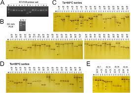 Development Of A Practical Nf1 Genetic Testing Method Through The Pilot Analysis Of Five Japanese Families With Neurofibromatosis Type 1 Sciencedirect