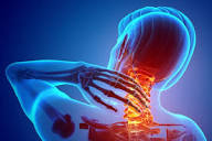 Hati-Hati, Sakit Leher Bisa Dipicu Oleh Gangguan Kesehatan Berikut