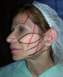 Cirugia plastica revista tapa 20071206:Tapa 1.qxd