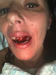 I can tell you in brutal detail how someone I called my love broke my jaw':  Victim urges men to do more to combat domestic abuse