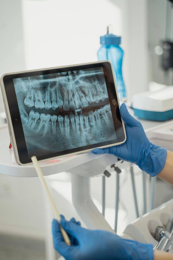 Dental X-Ray product image