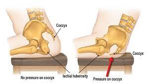 Tailbone Pain Explained | Provenance Rehabilition Pelvic Physical Therapy