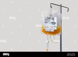 Image result for Platelet Transfusion