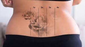 There are no proven 100% ways to remove all existence of a tattoo. Laser Treatments Bluffton Aesthetics