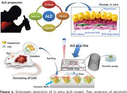 Each of the 16 pages includes beautiful diagrams of the organ anatomy, histology and location, along with text, video, audio and 3d models that support easy learning. Figure 1 From A 3d Alcoholic Liver Disease Model On A Chip Semantic Scholar