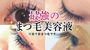 「エマーキット」の画像検索結果