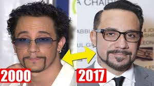 Did steve carell get a hair transplant. Aj Mclean Hair Transplant God Celebrities Hair Transplants