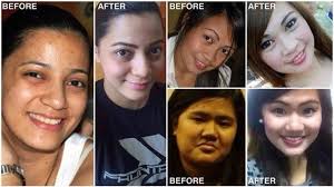 Black And White Bleaching Cream Results Pin On Skin Bleaching