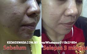 Nour ain beauty, nour ain kosmetik, nour ain skincare, nour ain stokis, nour ain kl, nour ain murah, nour ain set, nour ain pos, nour ain dealer, nour ain *semua item & set nour ain diskaun sebanyak 20% !! Nour Ain Testimoni Nour Ain 3in1 Review Harga Produk Nour Ain
