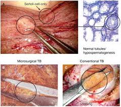 Shortness of breath, chest pain, or a cough (even coughing up blood) may. Male Infertility Cancer Therapy Advisor