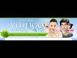 The Natural Vitiligo Treatment System Tm Special Offer With 3 Months Free Consultations Youtube