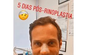 José carlos pereira filmado em momento de ternura com o filho. E Agora O Que Aconteceu Desta Vez Jose Carlos Pereira Surge Desfigurado E Com Tala No Nariz Atualidade Flash