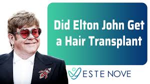Did steve carell get a hair transplant. Did Elton John Get A Hair Transplant Estenove Hair Transplant