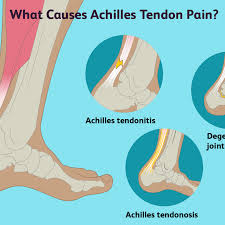 You may have peroneal tendonitis. Achilles Tendon Pain Causes Treatment And When To See A Doctor