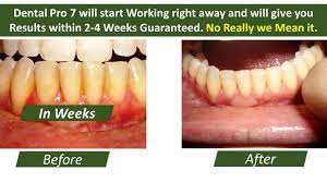 Gum disease occurs by a stick deposit on teeth where bacteria proliferate. Reverse Receding Gums Naturally