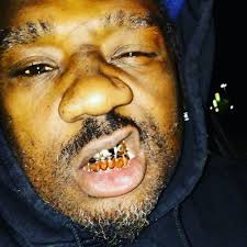 Gold Grills by flocca