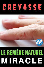 Epingle Sur Remedes Naturels