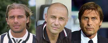 Troppo facile parlare col sorriso quando si vince. Trapianto Di Capelli Di Antonio Conte Svelato Il Mistero