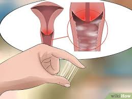 Vaginal odor is commonly caused by an inflammation in the vaginal area. 4 Ways To Get Rid Of Vaginal Odor Fast Wikihow