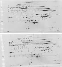 People who are septic are in a state. Identification Of A Panel Of Serum Protein Markers In Early Stage Of Sepsis And Its Validation In A Cohort Of Patients Sciencedirect