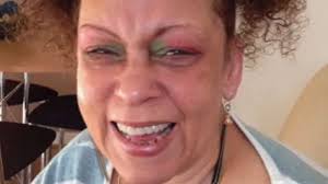 Covid-19: Sister 'written off' by do-not-resuscitate order