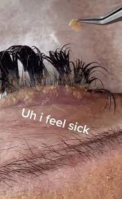 Vintage lashes in naples, fl explains how to best clean and take care of your new lashes. Beautician Shows Grim Consequence Of Not Cleaning Your Eyelash Extensions Mirror Online
