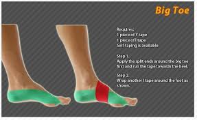And in so doing dragged to one side the. Kinesiology Taping Instructions The Big Toe Ktape Toe Ares Kinesiology Taping Kinesiology Tendonitis Treatment