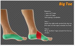 This easy to follow illustrated guide will teach you how to wrap a sprained wrist to ensure recovery. Kinesiology Taping Instructions The Big Toe Ktape Toe Ares Kinesiology Taping Kinesio Taping Physio Tape