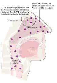 Von hautausschlägen berichten forscher dabei schon seit längerem. Corona Riechverlust Kann Auf Covid 19 Hindeuten