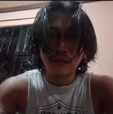 😭 Sobrang GRABEEE TO❗Dislocated Patella...🥺